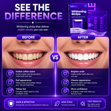 30-Minute Teeth Whitening Strips