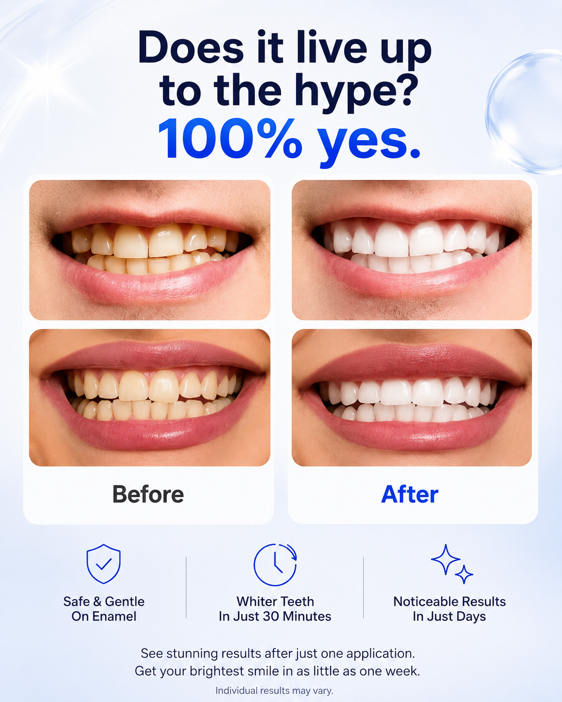 30-Minute Teeth Whitening Strips