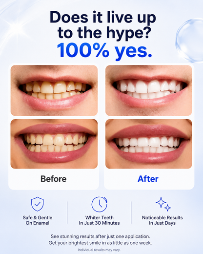 30-Minute Teeth Whitening Strips